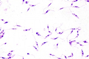 Uso de creme combinado a imunomoduladores é promissor contra leishmaniose cutânea