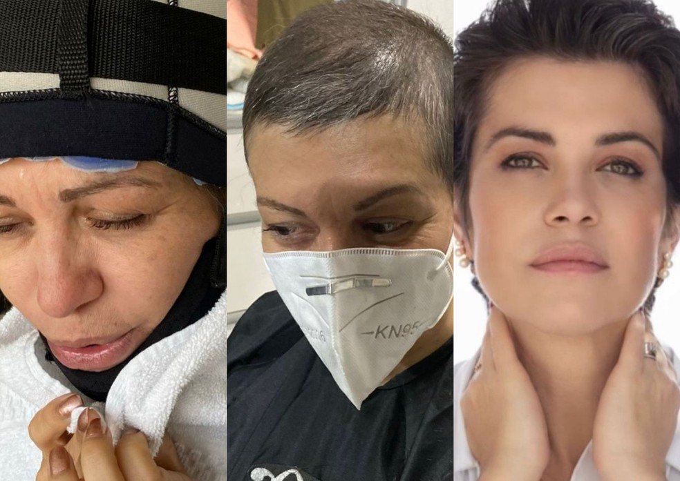 Médica perde cabelo durante quimioterapia e dá lição de autoestima no Outubro Rosa — Foto: Arquivo pessoal / CO Assessoria