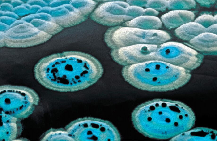 Um novo e poderoso antibiótico estava há décadas escondido à vista de todos