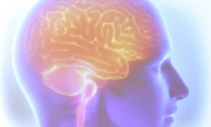 Acidente Vascular Cerebral AVC mata uma pessoa a cada seis minutos no Brasil