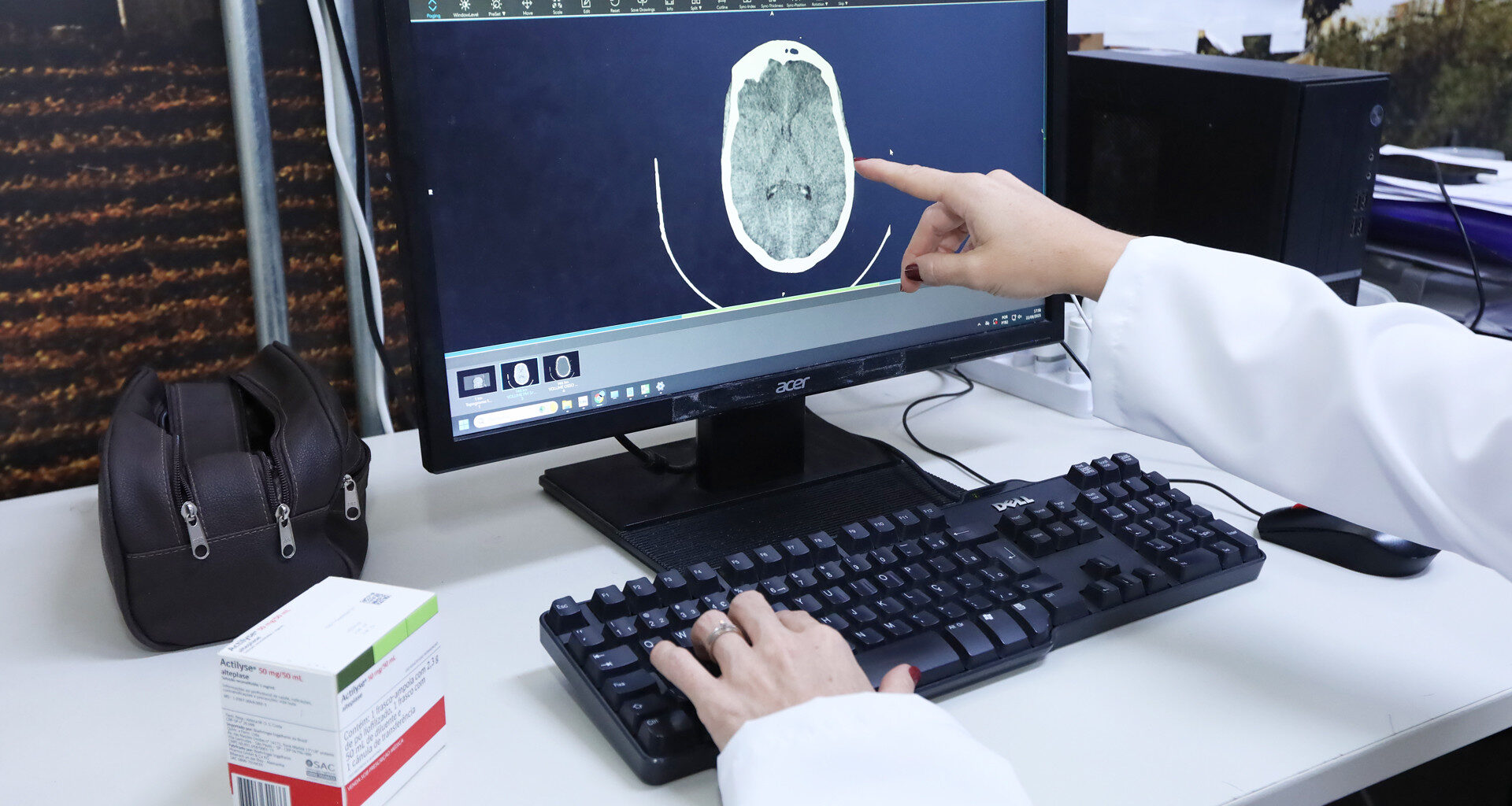 Acidente Vascular Cerebral: GDF reforça assistência emergencial