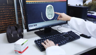 Acidente Vascular Cerebral: GDF reforça assistência emergencial