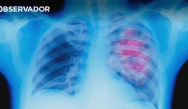 Estudo nacional vai determinar impacto da DPOC – Observador