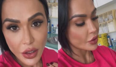 Gracyanne Barbosa mostra recuperação do joelho e retirada de pontos 14 dias após a cirurgia; vídeo