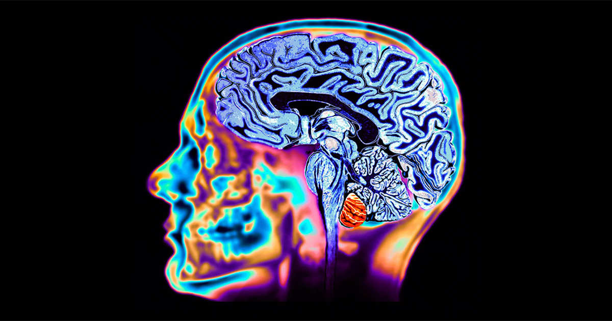 Poderá o lítio ser utilizado para prevenir a doença de Alzheimer?