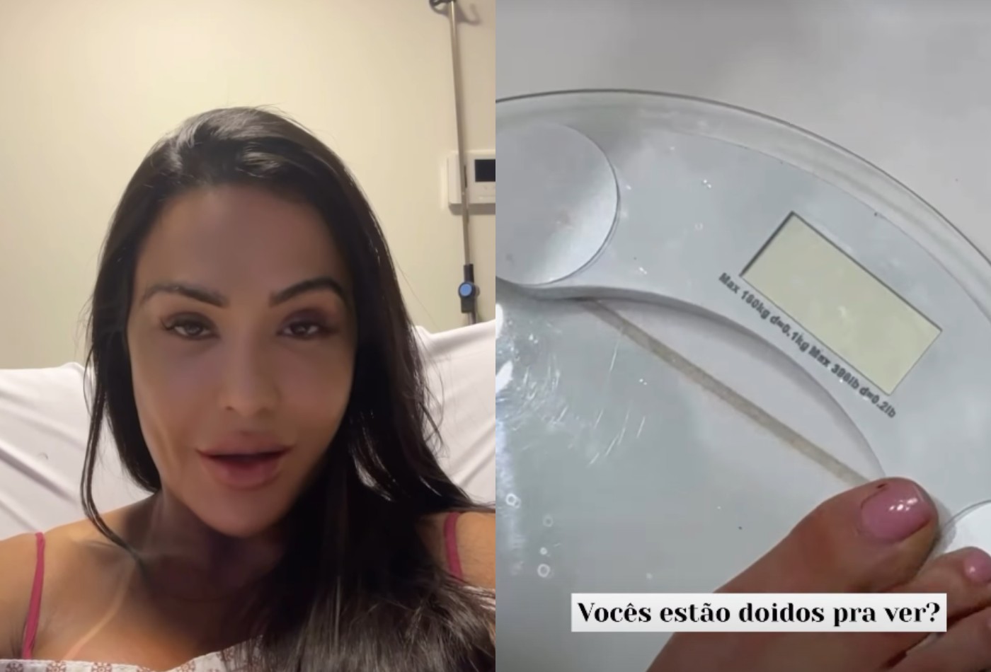Gracyanne Barbosa se surpreende com peso após internação: 'Que isso, gente?' - revistaquem.globo.com