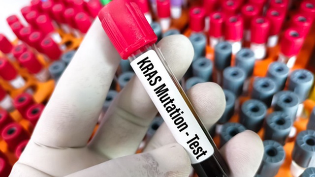 Investigadores espanhóis detectam e eliminam mutações causadoras de vários tipos de cancro