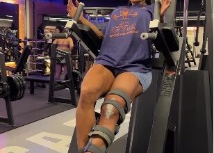 ‘Estou aprendendo uma nova forma de me relacionar com meu corpo’; diz Gracyanne Barbosa sobre o longo tratamento da lesão na perna