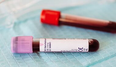 Etiópia confirma 3 mortos pelo vírus de Marburgo, semelhante ao Ébola, em novo surto