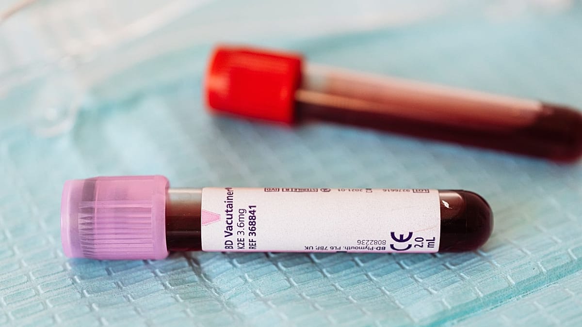 Etiópia confirma 3 mortos pelo vírus de Marburgo, semelhante ao Ébola, em novo surto