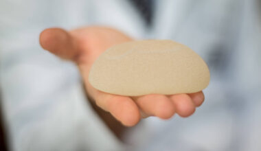 Explante de prótese de silicone cresce entre celebridades - 02/11/2025 - Equilíbrio