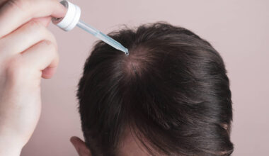 3 tipos de queda de cabelo e os tratamentos que funcionam - 16/11/2025 - Equilíbrio