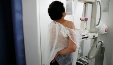 Saúde oferta novas terapias para câncer de mama e de reto - 06/11/2025 - Equilíbrio e Saúde