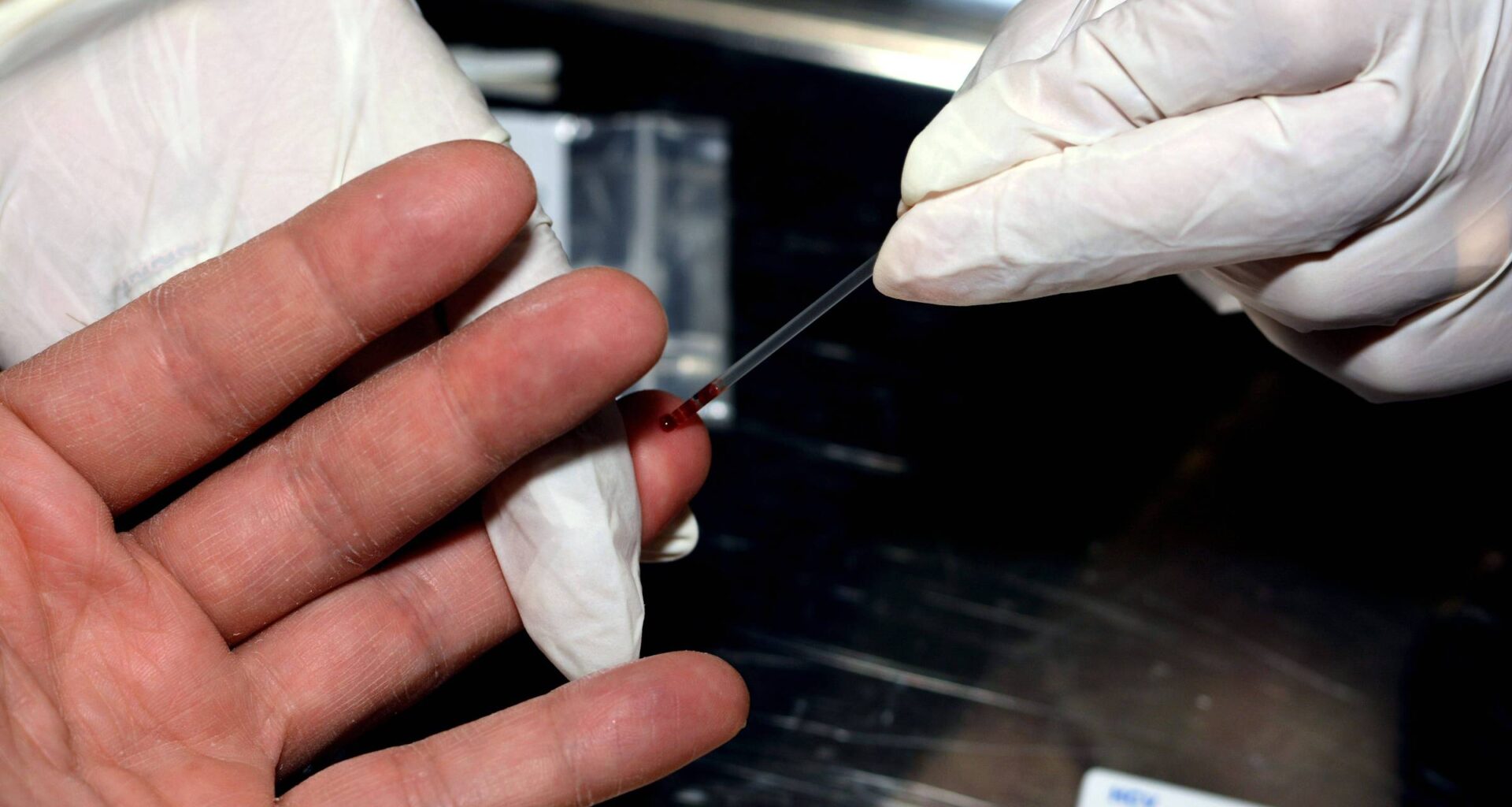 Pesquisa mapeia 22 vírus no sêmen que transmitem doenças - 16/11/2025 - Equilíbrio e Saúde