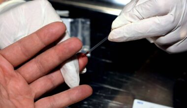 Pesquisa mapeia 22 vírus no sêmen que transmitem doenças - 16/11/2025 - Equilíbrio e Saúde