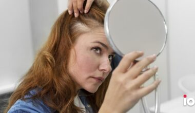 Queda de cabelo depois dos 40? Isto nunca pode faltar na alimentação, alerta especialista - Notícias de hoje