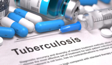 Cabo Verde atinge os primeiros marcos da estratégia para o fim da tuberculose entre 2020 e 2024 – OMS