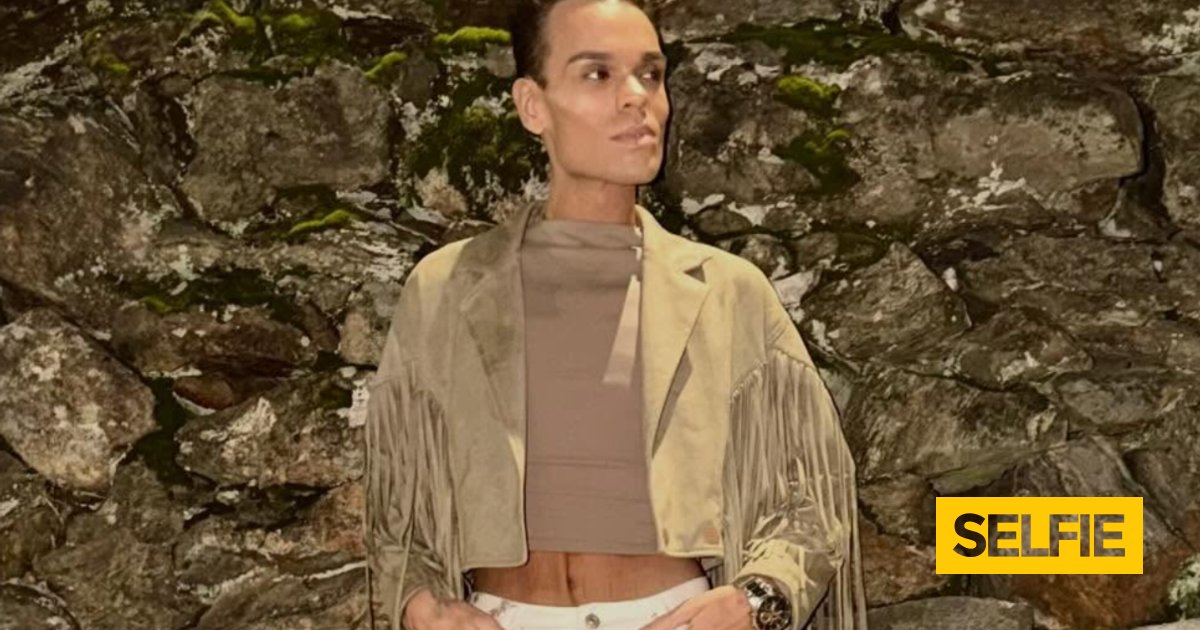 "Não está magro. Está esquelético": associado a "doença gravíssima", Zé Lopes tem algo a dizer!