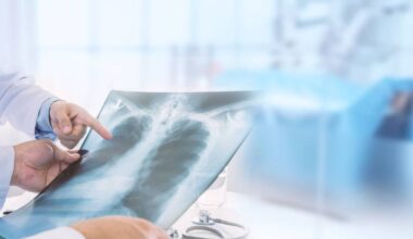 Bruxelas autoriza primeiro tratamento para doença pulmonar crónica na UE