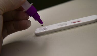 Morador dos Estados Unidos é diagnosticado com vírus nunca visto em humanos – Noticias R7