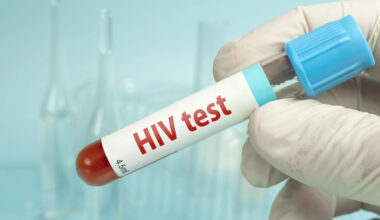 ​Cabo Verde acredita estar no caminho certo para eliminar VIH/Sida até 2030