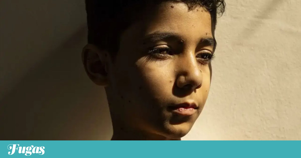 O que fazer? Terça é dia de World Press Photo e Couves com Feijões | Lazer