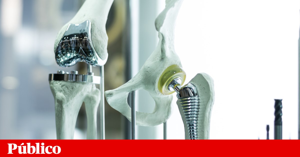 Ossos “à medida” vão ser possíveis com implantes criados com IA e impressão 3D | Saúde