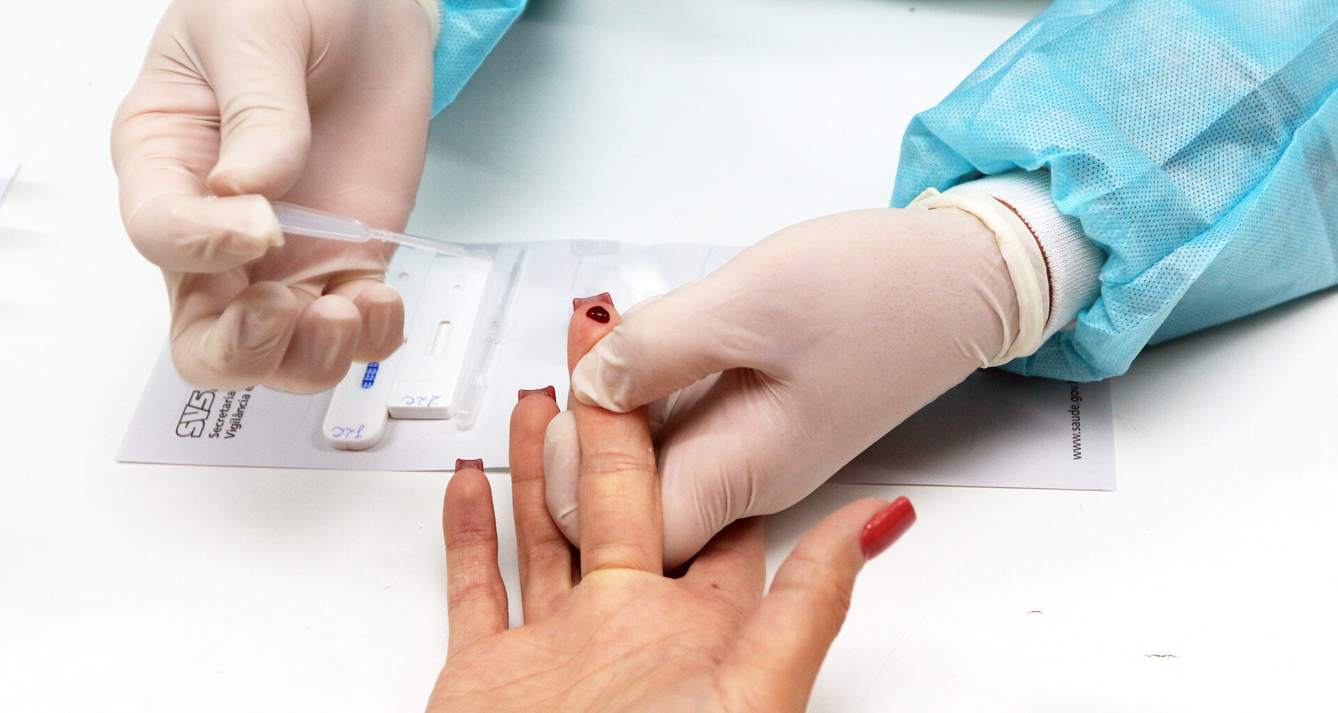 ​Luta contra o HIV: Saúde leva testagem rápida e orientações ao Setor Comercial Sul