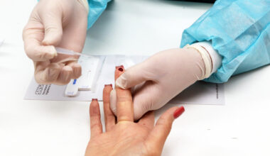 ​Luta contra o HIV: Saúde leva testagem rápida e orientações ao Setor Comercial Sul