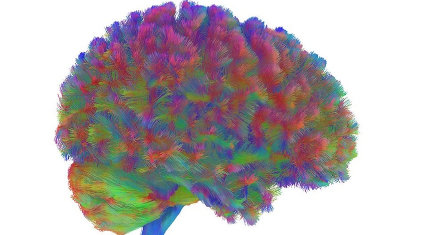 Pontos de viragem do cérebro humano. Adolescência vai até aos 32 anos e atinge o pico cerebral