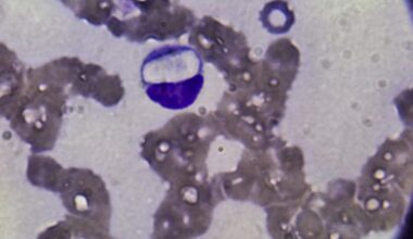 Hepatozoon canis em canídeo domesticado: relato de caso