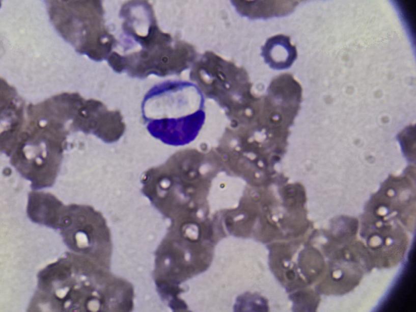 Hepatozoon canis em canídeo domesticado: relato de caso