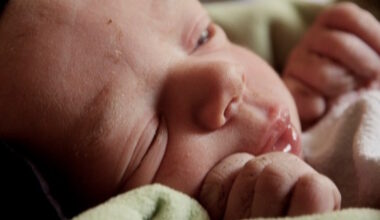 Reavaliado valor da proteína C-reativa no rastreio da sépsis neonatal