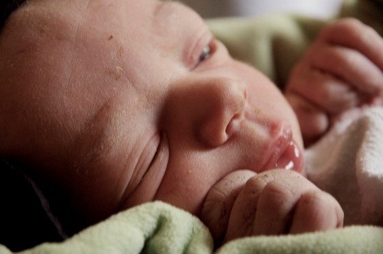 Reavaliado valor da proteína C-reativa no rastreio da sépsis neonatal