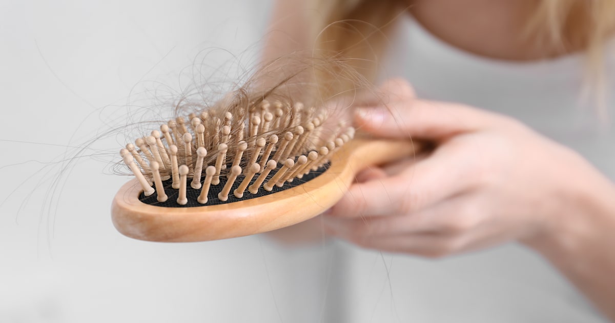 Conheça três tipos de queda de cabelo e os tratamentos que realmente ajudam
