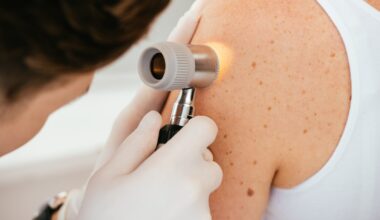 Metade dos brasileiros nunca foi ao dermatologista — e 25% nem sabem que esse profissional é médico