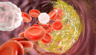 O risco da Lipoproteína