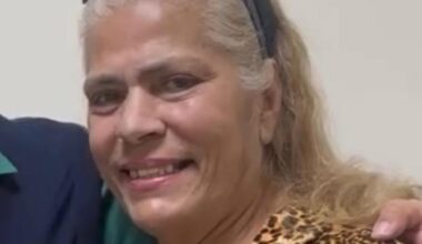 Ex-chacrete Lia Hollywood morre após um mês internada por ataque de pitbull do filho