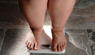 Guia da Farmácia | Avanço da obesidade no país acende alerta para prevenção