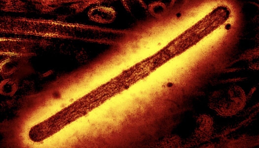 Registada nos EUA primeira morte no mundo causada pela estirpe H5N5 de gripe das aves