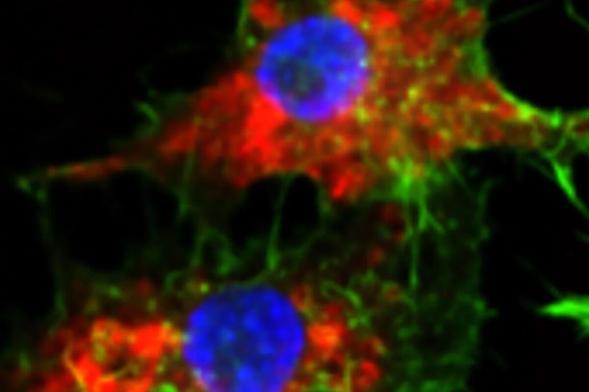 Novo medicamento é 20.000 vezes mais eficaz a matar o cancro (sem efeitos secundários)