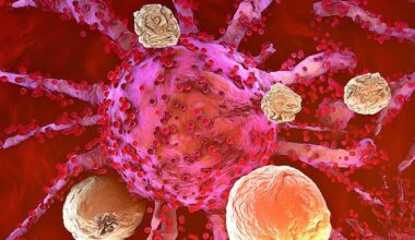 Cientistas eliminam completamente leucemia em ensaio pré-clínico