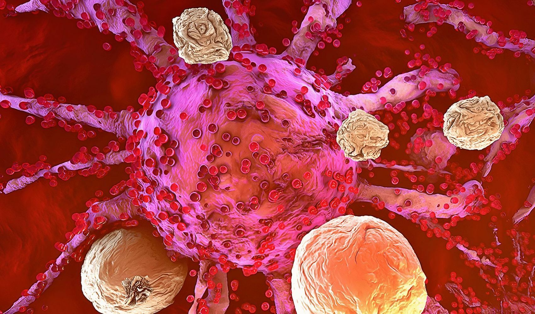 Cientistas eliminam completamente leucemia em ensaio pré-clínico