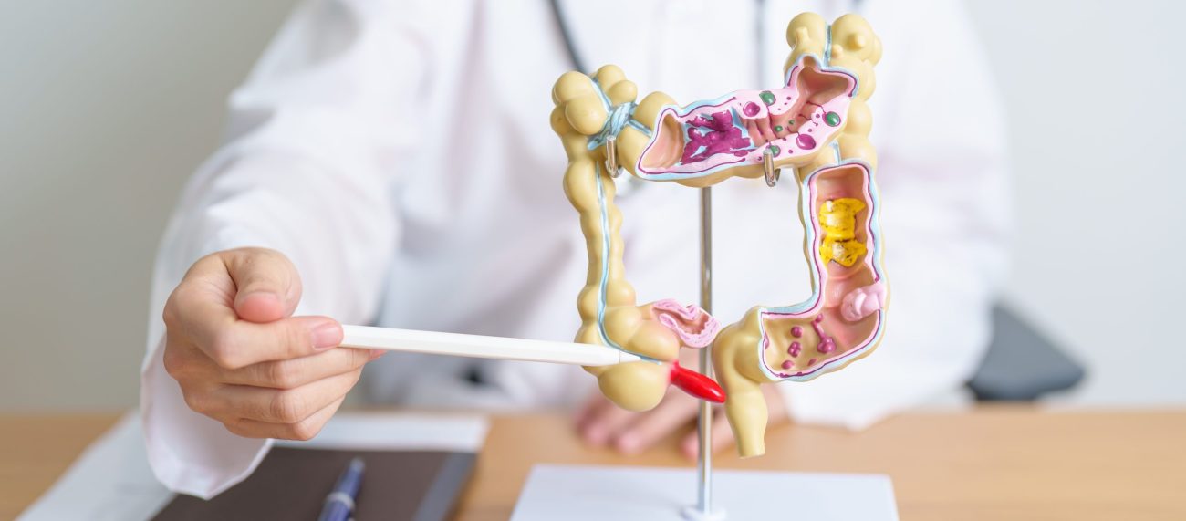 Substância faz bem para a flora intestinal
