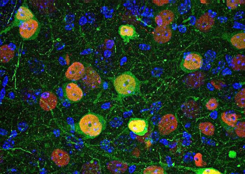 Imagem de microscopia confocal mostrando células da amígdala basolateral infectadas por um vírus geneticamente modificado • Instituto de Neurociências UMH CSIC/Divulgação