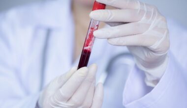 Descoberto tipo sanguíneo "híbrido" incrivelmente raro. Apenas 3 pessoas o têm