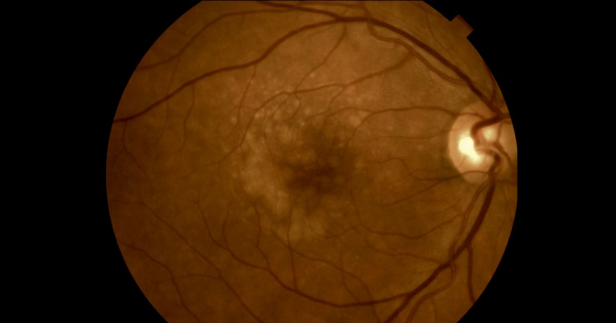 Especialistas pediram cautela porque resultados ainda são recentes