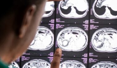 Especialista esclarece avanços e limites da IA no diagnóstico de AVC