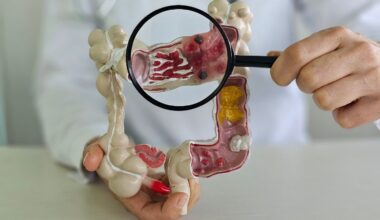 A ciência é clara: eliminar esse alimento pode reduzir drasticamente o risco de câncer, principalmente o câncer de cólon