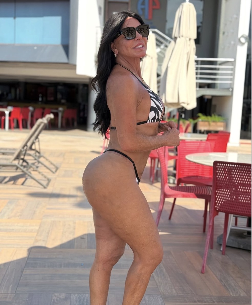 Gretchen falou sobre procedimentos estéticos e retoque no bumbum — Foto: Divulgação